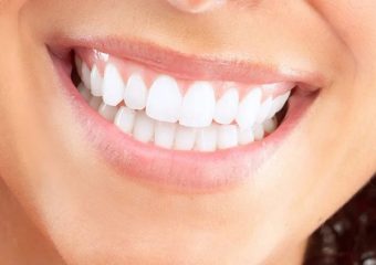 درمان لثه سفید شامل چه روش هایی می شود؟ | بهترین دندانپزشک اصفهان - بهترین ایمپلنت اصفهان - بهترین دندانپزشک زیبایی اصفهان - بهترین دندانپزشک کودکان اصفهان