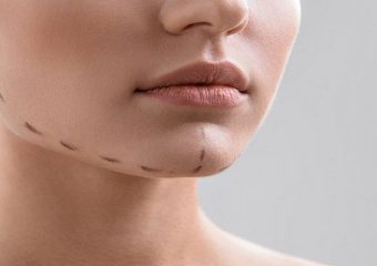 مراقبت های پس از جراحی فک | بهترین دندانپزشک اصفهان - بهترین ایمپلنت اصفهان - بهترین دندانپزشک زیبایی اصفهان - بهترین دندانپزشک کودکان اصفهان