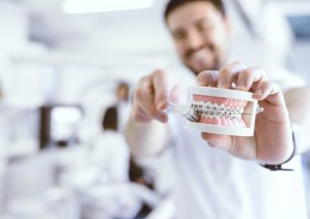 جویدن آدامس در طول درمان ارتودنسی | بهترین ایمپلنت اصفهان | بهترین دندانپزشک زیبایی اصفهان | دکتر مکانیک | بهترین دندانپزشک اصفهان | بهترین دندانپزشک کودکان اصفهان |