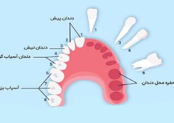پیشگیری از پوسیدگی دندان های شش | بهترین دندانپزشک اصفهان - بهترین ایمپلنت اصفهان - بهترین دندانپزشک زیبایی اصفهان - بهترین دندانپزشک کودکان اصفهان