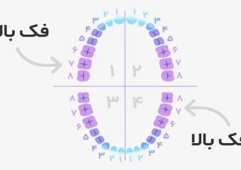 دندان شماره شش | بهترین دندانپزشک اصفهان - بهترین ایمپلنت اصفهان - بهترین دندانپزشک زیبایی اصفهان - بهترین دندانپزشک کودکان اصفهان