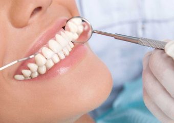 بررسی انواع لمینت‌های سرامیکی دندان | بهترین دندانپزشک زیبایی اصفهان | دکتر ندا مکانیک