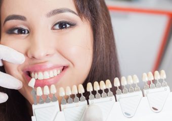 بهترین ایمپلنت اصفهان | بهترین دندانپزشک زیبایی اصفهان | مزایای لمینت سرامیکی دندان‌ها | بهترین دندانپزشک اصفهان | دکتر ندا مکانیک