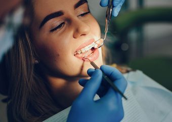 مقایسه ارتودنسی و روکش دندان | بهترین دندانپزشک زیبایی اصفهان | دکتر ندا مکانیک