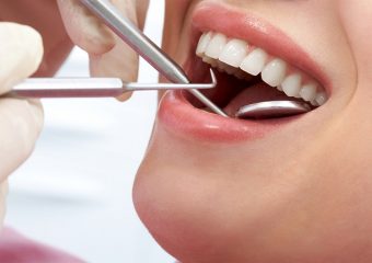 درمان احساس بزرگی روکش دندان | بهترین دندانپزشک اصفهان | دکتر ندا مکانیک