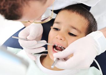 دندان گچی در کودکان | بهترین ایمپلنت اصفهان | بهترین دندانپزشک زیبایی اصفهان | دکتر ندا مکانیک