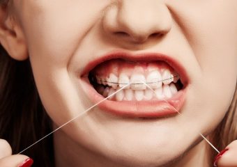 بهترین ایمپلنت اصفهان | بهترین دندانپزشک زیبایی اصفهان | روش‌های مختلف اصلاح فرم دندان | بهترین دندانپزشک اصفهان | دکتر ندا مکانیک