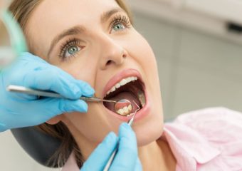 علل سفید شدن جای دندان کشیده شده | بهترین ایمپلنت اصفهان | دکتر ندا مکانیک