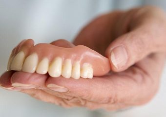 مزایا و معایب دندان مصنوعی ژله ای تکه ای | بهترین دندانپزشک زیبایی اصفهان | دکتر ندا مکانیک