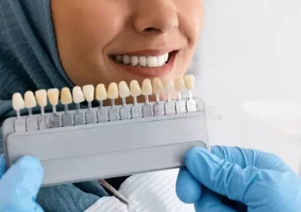 بهترین ایمپلنت اصفهان | بهترین دندانپزشک زیبایی اصفهان | مقایسه ونیر و روکش دندان | بهترین دندانپزشک اصفهان | دکتر ندا مکانیک