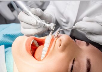 آشنایی با جرمگیری عمیق دندان | بهترین ایمپلنت اصفهان | دکتر ندا مکانیک