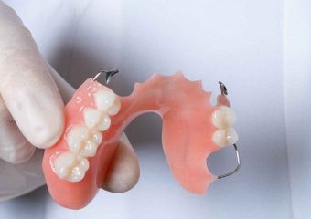 انواع مختلف دندان مصنوعی تکه ای ثابت | بهترین ایمپلنت اصفهان | دکتر ندا مکانیک