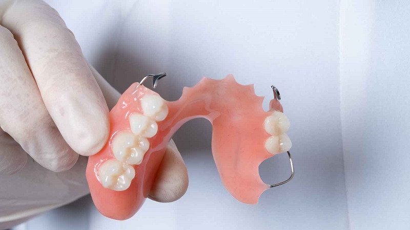 انواع مختلف دندان مصنوعی تکه ای ثابت | بهترین ایمپلنت اصفهان | دکتر ندا مکانیک