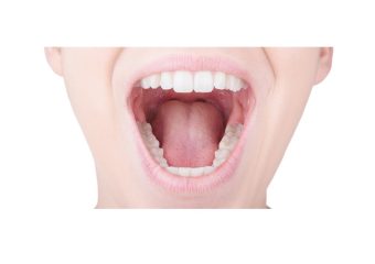 علل کم باز شدن دهان | بهترین ایمپلنت اصفهان | بهترین دندانپزشک زیبایی اصفهان | دکتر ندا مکانیک