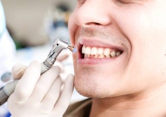 عوارض احتمالی جرم گیری دندان | بهترین دندانپزشک اصفهان | دکتر ندا مکانیک