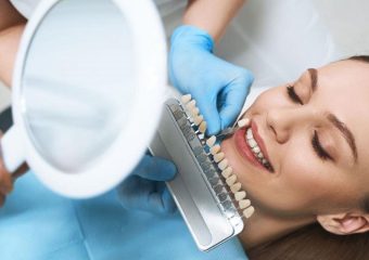 بهترین ایمپلنت اصفهان | مقایسه لمینت دندان و بلیچینگ دندان | بهترین دندانپزشک زیبایی اصفهان | دکتر ندا مکانیک