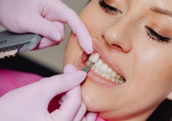 نکاتی در مورد تراش دندان برای لمینت | بهترین ایمپلنت اصفهان | بهترین دندانپزشک زیبایی اصفهان | دکتر ندا مکانیک