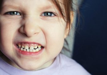 همه چیز درباره دندان قروچه کودکان | بهترین دندانپزشک کودکان اصفهان | دکتر ندا مکانیک