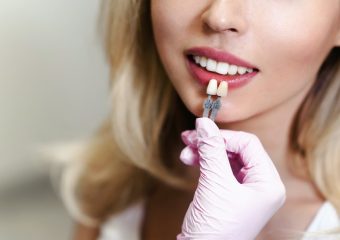 بهترین ایمپلنت اصفهان | بهترین دندانپزشک زیبایی اصفهان | کاربرد و مزیت انواع لمینت دندان | بهترین دندانپزشک اصفهان | دکتر ندا مکانیک