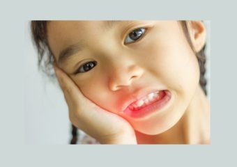 بهترین ایمپلنت اصفهان | بهترین دندانپزشک زیبایی اصفهان | روش های ترمیم دندان شکسته کودکان | بهترین دندانپزشک کودکان اصفهان | دکتر ندا مکانیک