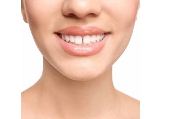 بهترین ایمپلنت اصفهان | بهترین دندانپزشک زیبایی اصفهان | روشهای درمانی برای شکاف بین دندان‌ها | بهترین دندانپزشک اصفهان | دکتر ندا مکانیک