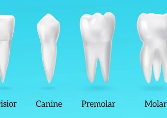 بهترین ایمپلنت اصفهان | بهترین دندانپزشک زیبایی اصفهان | شناخت انواع دندان | بهترین دندانپزشک اصفهان | دکتر ندا مکانیک