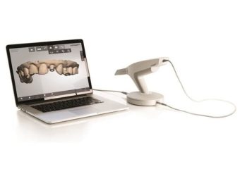 بهترین ایمپلنت اصفهان | بهترین دندانپزشک زیبایی اصفهان | موارد استفاده از تکنولوژی (CAD/CAM) در دندانپزشکی | بهترین دندانپزشک اصفهان | دکتر ندا مکانیک