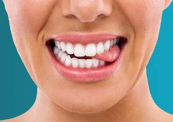 بهترین ایمپلنت اصفهان | بهترین دندانپزشک زیبایی اصفهان | عوارض گاز گرفتن زبان و لب | بهترین دندانپزشک اصفهان | دکتر ندا مکانیک