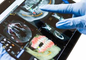 مقایسه ایمپلنت دندان دیجیتال و سنتی | بهترین ایمپلنت اصفهان | بهترین دندانپزشک زیبایی اصفهان | دکتر ندا مکانیک