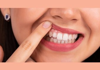 بهترین ایمپلنت اصفهان | بهترین دندانپزشک زیبایی اصفهان | روش ‌های مختلف درمان حساسیت لثه | بهترین دندانپزشک کودکان اصفهان | دکتر ندا مکانیک