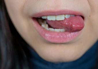 بهترین ایمپلنت اصفهان | بهترین دندانپزشک زیبایی اصفهان | علل و عوامل گاز گرفتن زبان | بهترین دندانپزشک کودکان اصفهان | دکتر ندا مکانیک