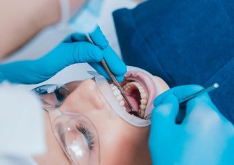 بهترین ایمپلنت اصفهان | بهترین دندانپزشک زیبایی اصفهان | موارد نیاز به جراحی دهان | بهترین دندانپزشک کودکان اصفهان | دکتر ندا مکانیک