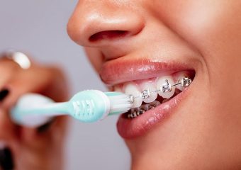 بهترین ایمپلنت اصفهان | بهترین دندانپزشک زیبایی اصفهان | نکات مهم در انتخاب مسواک ارتودنسی | بهترین دندانپزشک کودکان اصفهان | دکتر ندا مکانیک