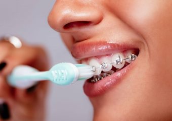 بهترین ایمپلنت اصفهان | بهترین دندانپزشک زیبایی اصفهان | نکات مراقبتی در استفاده از مسواک ارتودنسی | بهترین دندانپزشک کودکان اصفهان | دکتر ندا مکانیک