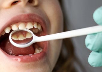 بهترین ایمپلنت اصفهان | بهترین دندانپزشک زیبایی اصفهان | ابزارهای دیجیتال در تشخیص زودهنگام مشکلات فک و دندان کودکان | بهترین دندانپزشک کودکان اصفهان | دکتر ندا مکانیک