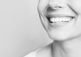 بهترین ایمپلنت اصفهان | ارتباط بهداشت دهان و دندان با زیبایی لبخند | بهترین دندانپزشک زیبایی اصفهان | دکتر ندا مکانیک