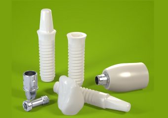 بهترین ایمپلنت اصفهان | ایمپلنت‌ سرامیکی جایگزین طبیعی‌تر برای دندان‌ از دست رفته | بهترین دندانپزشک زیبایی اصفهان | دکتر ندا مکانیک