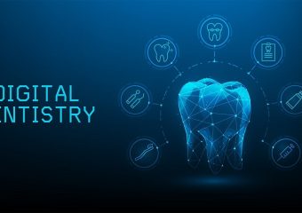 تاثیر دندانپزشکی دیجیتال در کاهش هزینه و زمان درمان | بهترین ایمپلنت اصفهان | بهترین دندانپزشک زیبایی اصفهان | دکتر ندا مکانیک