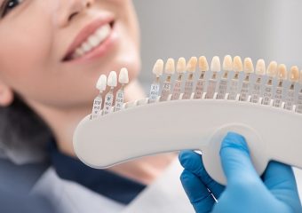 بهترین ایمپلنت اصفهان | نقش ونیرهای سرامیکی دندان در زیبایی لبخند | بهترین دندانپزشک زیبایی اصفهان | دکتر ندا مکانیک