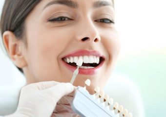 بهترین ایمپلنت اصفهان | کامپوزیت ونیرها و میکروابریژن در بهبود ظاهر دندان‌ها | بهترین دندانپزشک زیبایی اصفهان | دکتر ندا مکانیک