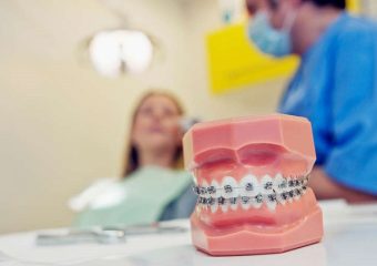 بهترین ایمپلنت اصفهان | بهترین دندانپزشک زیبایی اصفهان | افراد مناسب برای انجام ارتودنسی فانکشنال | بهترین دندانپزشک اصفهان | دکتر ندا مکانیک