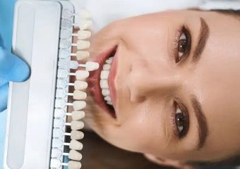 بهترین ایمپلنت اصفهان | بهترین دندانپزشک زیبایی اصفهان | بهترین دندانپزشک اصفهان | دکتر ندا مکانیک |انواع لمینت‌های سرامیکی بر پایه اجزای سازنده