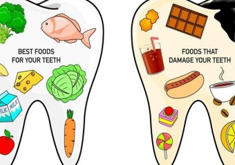 بهترین ایمپلنت اصفهان | بهترین دندانپزشک زیبایی اصفهان | بدترین رژیم غذایی برای دندان | بهترین دندانپزشک اصفهان | دکتر ندا مکانیک