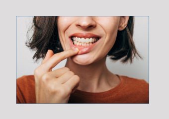 بهترین ایمپلنت اصفهان | بهترین دندانپزشک زیبایی اصفهان | درمان های پزشکی برای درد لثه | بهترین دندانپزشک اصفهان | دکتر ندا مکانیک