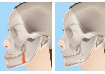 دستگاه‌های مخصوص اصلاح موقعیت فک | بهترین ایمپلنت اصفهان | بهترین دندانپزشک زیبایی اصفهان | دکتر ندا مکانیک