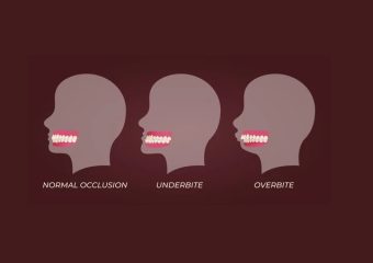 علل و علائم ناهنجاری‌های فک و دهان | بهترین ایمپلنت اصفهان | بهترین دندانپزشک زیبایی اصفهان | دکتر ندا مکانیک