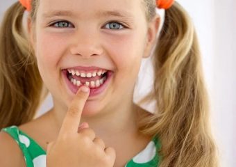 بهترین ایمپلنت اصفهان | بهترین دندانپزشک زیبایی اصفهان | بهترین دندانپزشک اصفهان | دکتر ندا مکانیک | عوارض و خطرات نیفتادن دندان شیری