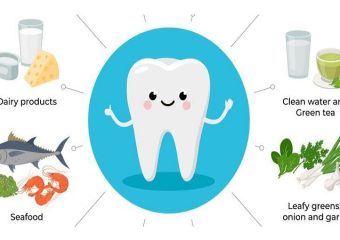 بهترین ایمپلنت اصفهان | بهترین دندانپزشک زیبایی اصفهان | ویتامین هایی برای محافظت از دهان و دندان | بهترین دندانپزشک کودکان اصفهان | دکتر ندا مکانیک