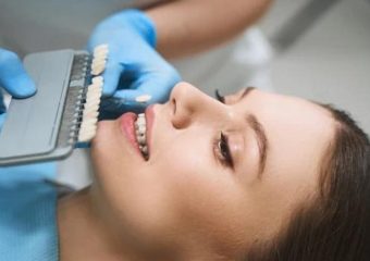 جدیدترین برندهای لمینت سرامیکی دندان | بهترین دندانپزشک زیبایی اصفهان | دکتر ندا مکانیک