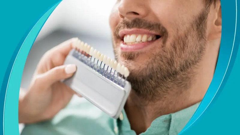 بهترین ایمپلنت اصفهان | بهترین دندانپزشک زیبایی اصفهان | بهترین دندانپزشک اصفهان | دکتر ندا مکانیک |راهنمای انتخاب رنگ لمینت دندان جلو